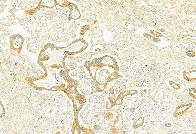 PLCE1 Antibody in Immunohistochemistry (Paraffin) (IHC (P))