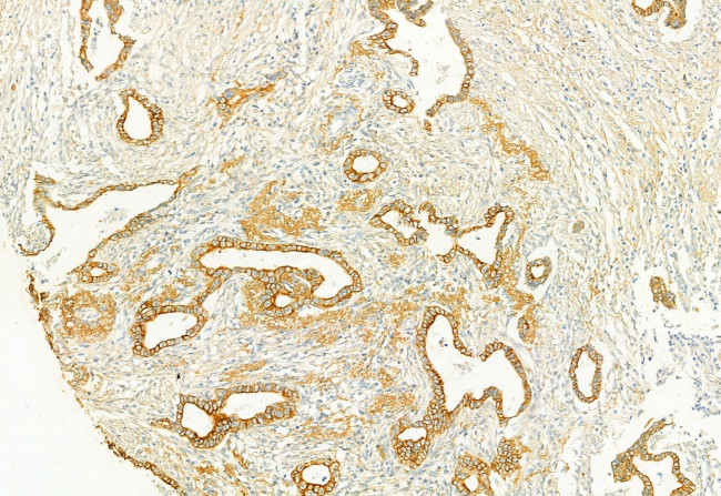 PLCE1 Antibody in Immunohistochemistry (Paraffin) (IHC (P))