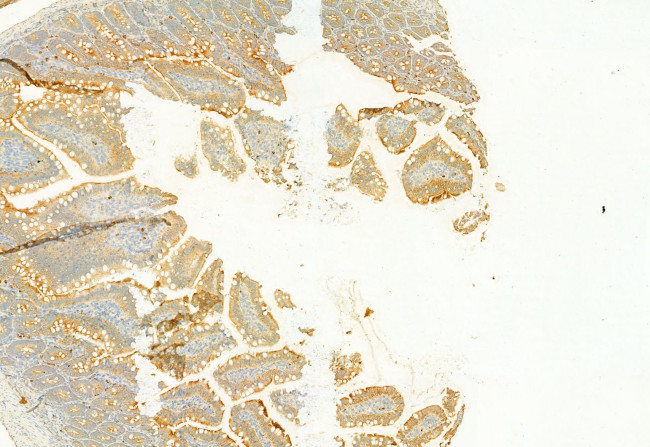 PLCE1 Antibody in Immunohistochemistry (Paraffin) (IHC (P))