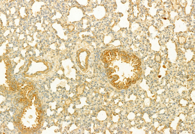 PLCE1 Antibody in Immunohistochemistry (Paraffin) (IHC (P))