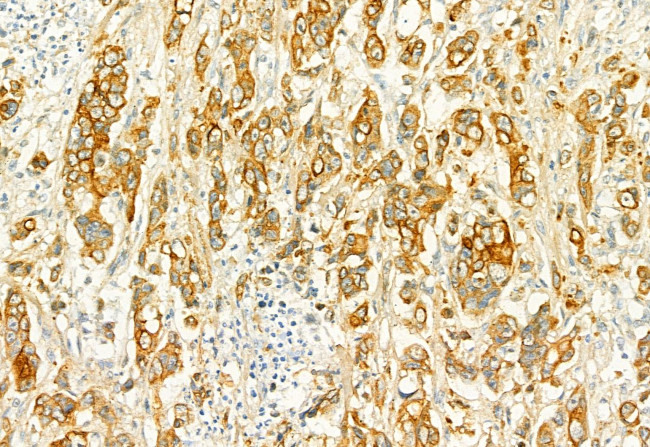 PLCE1 Antibody in Immunohistochemistry (Paraffin) (IHC (P))