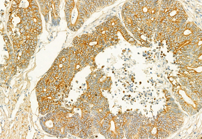 PLCE1 Antibody in Immunohistochemistry (Paraffin) (IHC (P))