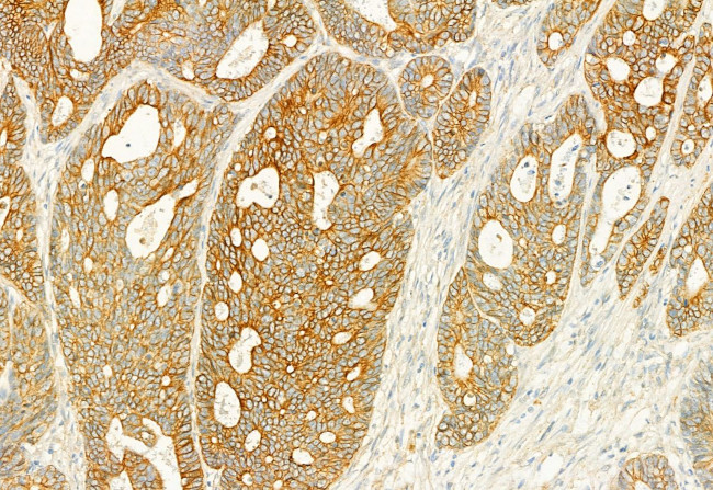 PLCE1 Antibody in Immunohistochemistry (Paraffin) (IHC (P))