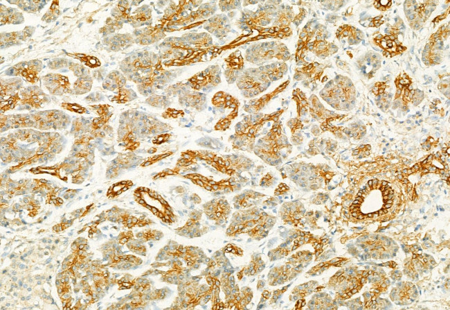 PLCE1 Antibody in Immunohistochemistry (Paraffin) (IHC (P))