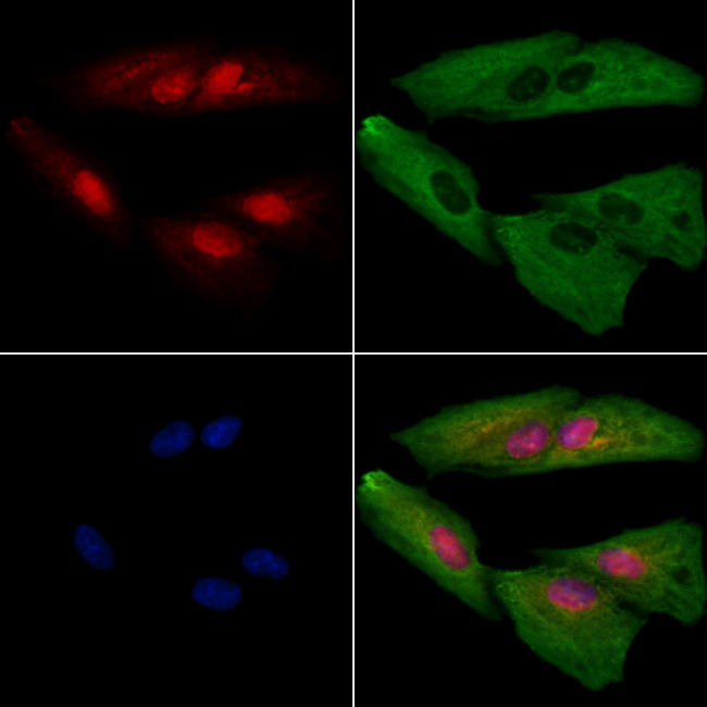 SAP130 Antibody in Immunocytochemistry (ICC/IF)