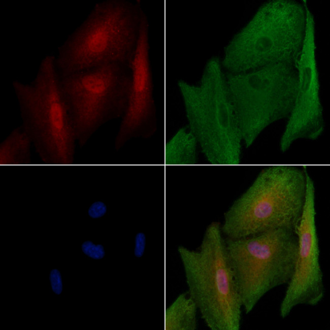 KIF23 Antibody in Immunocytochemistry (ICC/IF)