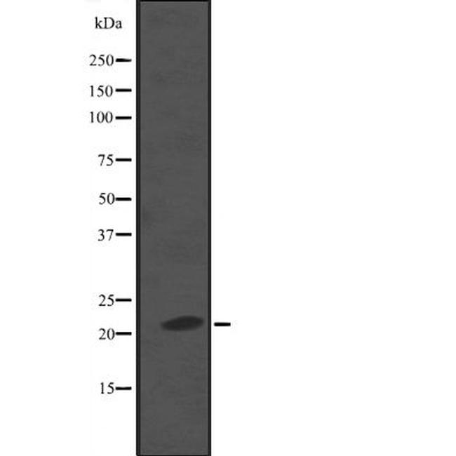 KappaB ras2 Antibody in Western Blot (WB)