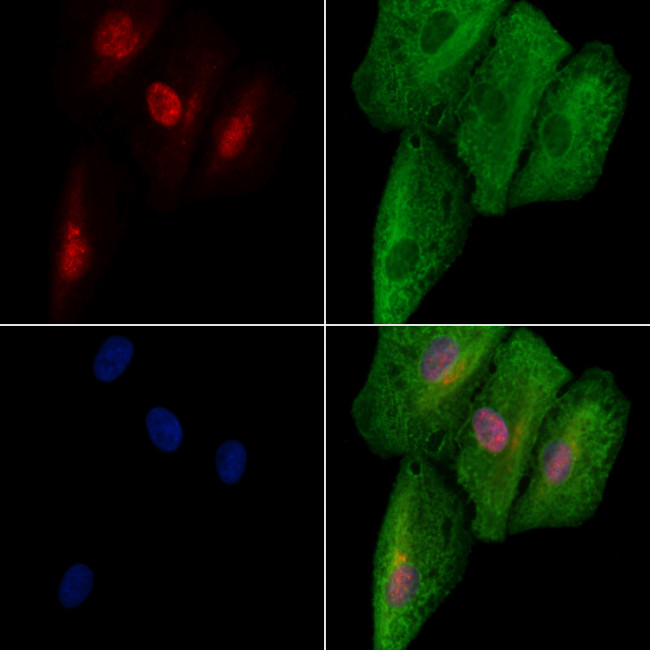 E2F8 Antibody in Immunocytochemistry (ICC/IF)