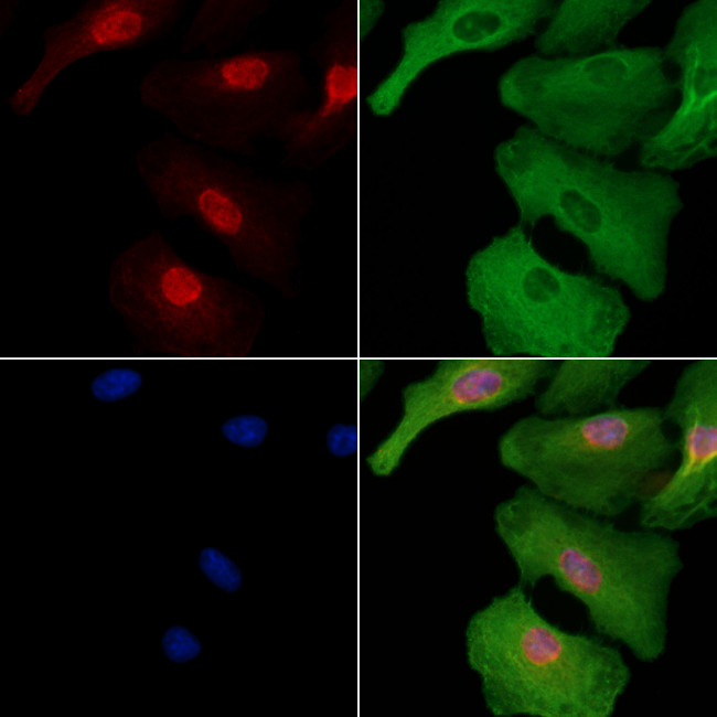 KLF14 Antibody in Immunocytochemistry (ICC/IF)