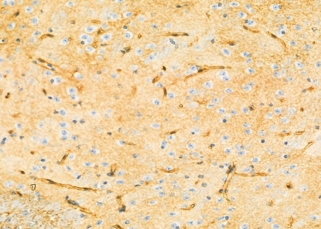 ZDHHC13 Antibody in Immunohistochemistry (Paraffin) (IHC (P))