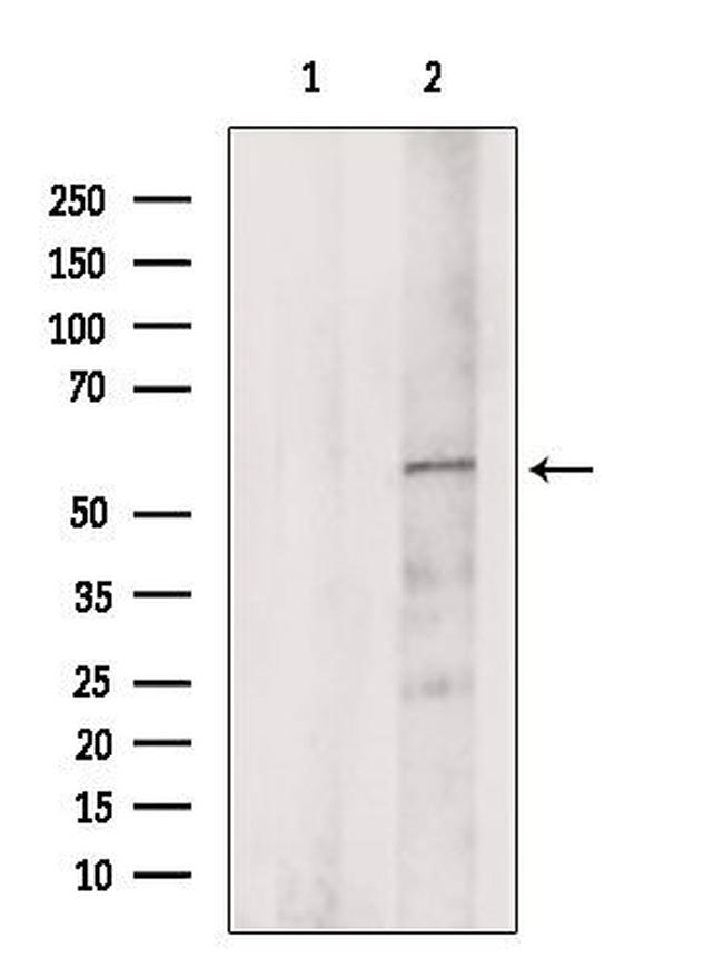 ZDHHC13 Antibody in Western Blot (WB)