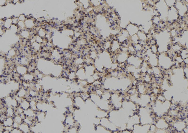 PAX1 Antibody in Immunohistochemistry (Paraffin) (IHC (P))