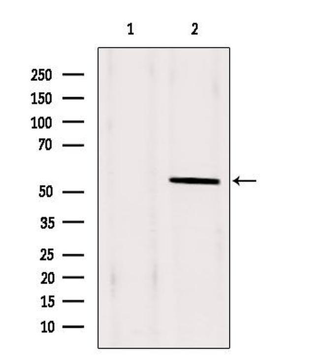 PAX1 Antibody in Western Blot (WB)