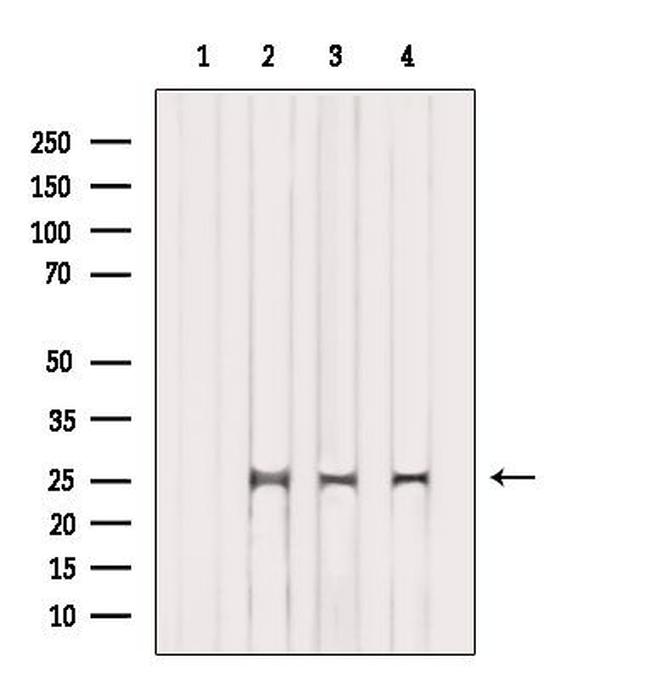 PROP1 Antibody in Western Blot (WB)