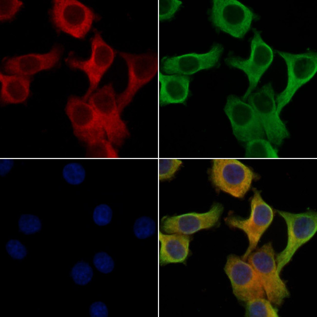 CYP7A1 Antibody in Immunocytochemistry (ICC/IF)