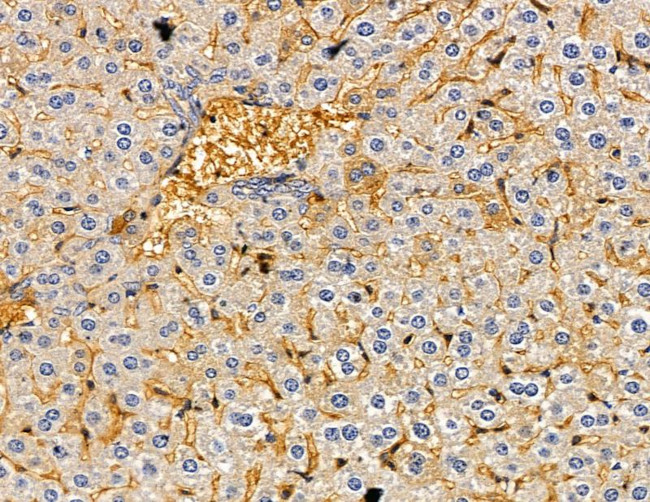 CYP7A1 Antibody in Immunohistochemistry (Paraffin) (IHC (P))