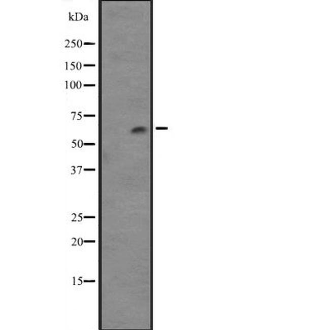 CYP4F12 Antibody in Western Blot (WB)