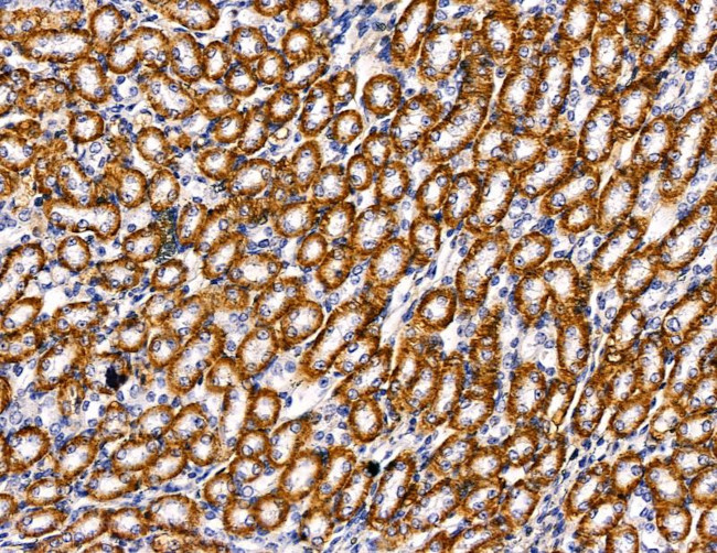 PI3K p55 gamma Antibody in Immunohistochemistry (Paraffin) (IHC (P))