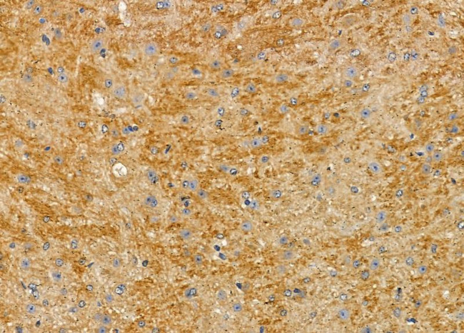 PI3K p55 gamma Antibody in Immunohistochemistry (Paraffin) (IHC (P))