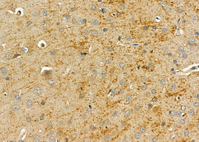 PI3K p55 gamma Antibody in Immunohistochemistry (Paraffin) (IHC (P))