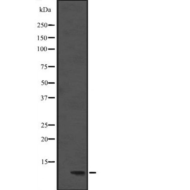 DYNLL1 Antibody in Western Blot (WB)