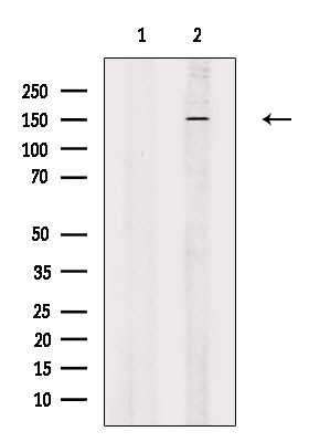 Attractin Antibody in Western Blot (WB)