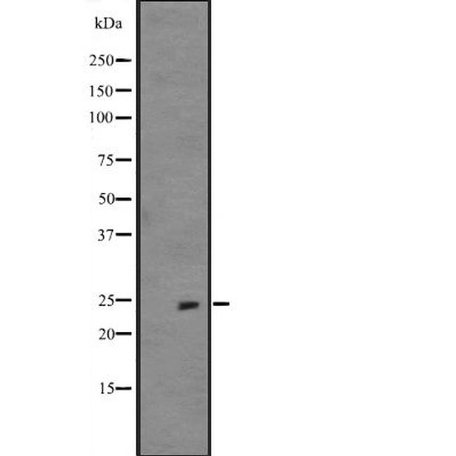 FGF19 Antibody in Western Blot (WB)