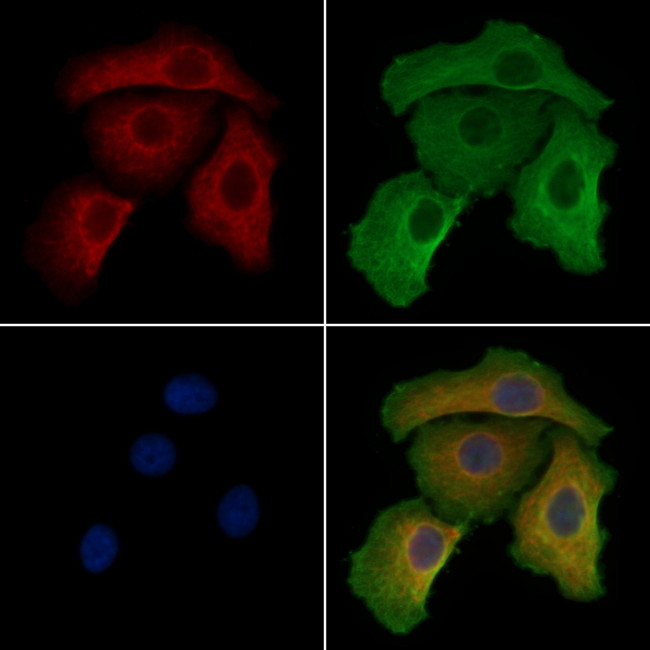 MAGEB5 Antibody in Immunocytochemistry (ICC/IF)