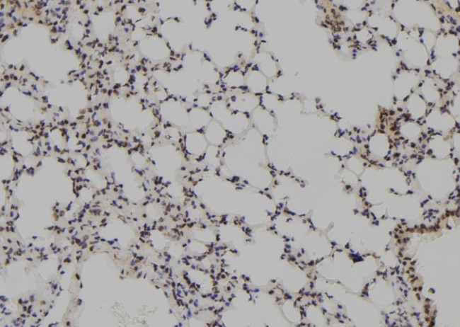 MAGEB5 Antibody in Immunohistochemistry (Paraffin) (IHC (P))