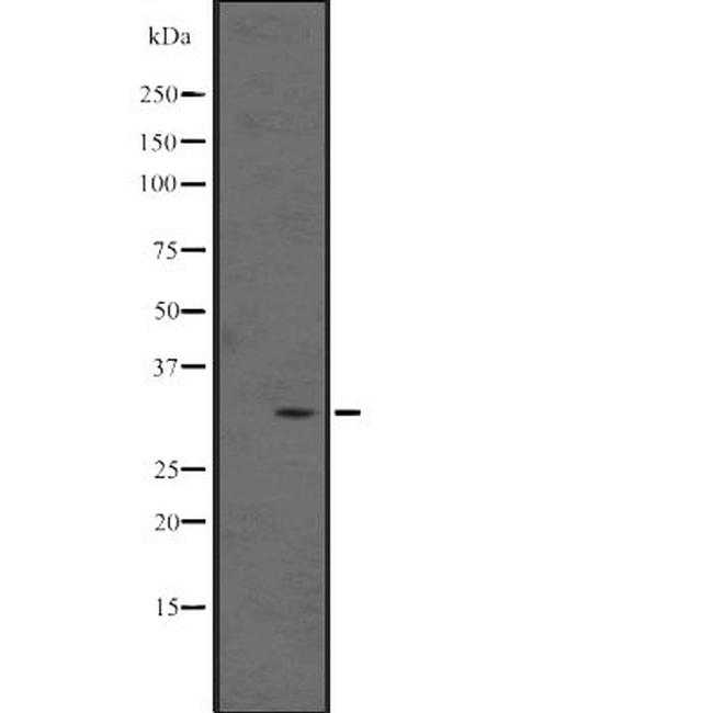 MAGEB5 Antibody in Western Blot (WB)