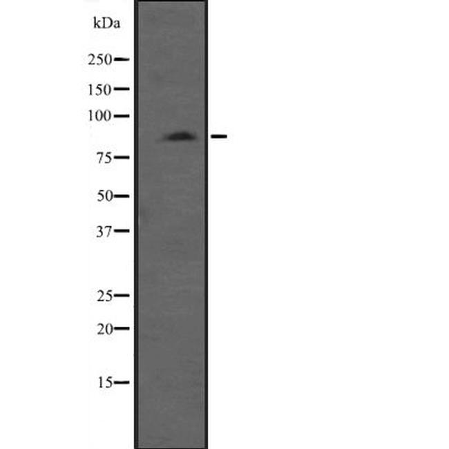 MLCK Antibody in Western Blot (WB)