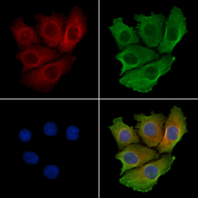 TRIB2 Antibody in Immunocytochemistry (ICC/IF)