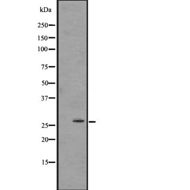 CEACAM3 Antibody in Western Blot (WB)