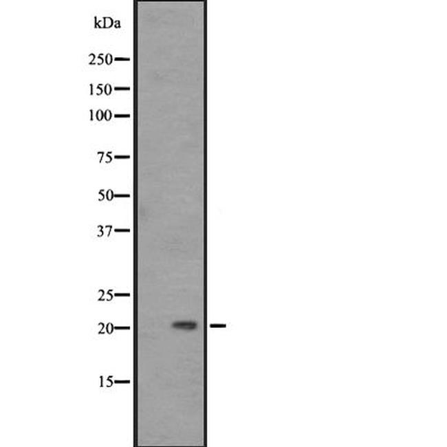 Placental Protein 14 Antibody in Western Blot (WB)