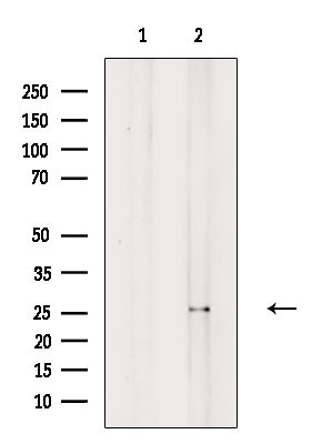 Kallikrein 12 Antibody in Western Blot (WB)