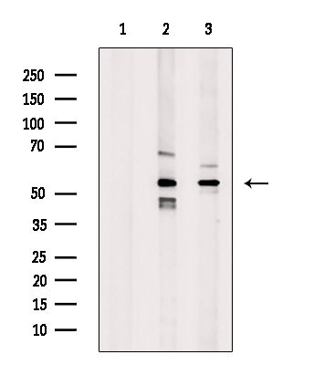 HTR3A Antibody in Western Blot (WB)