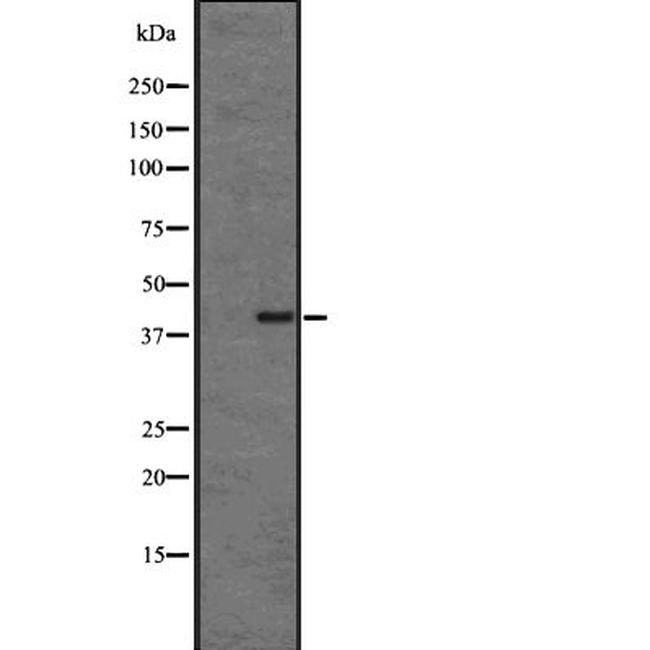 CMKLR1 Antibody in Western Blot (WB)