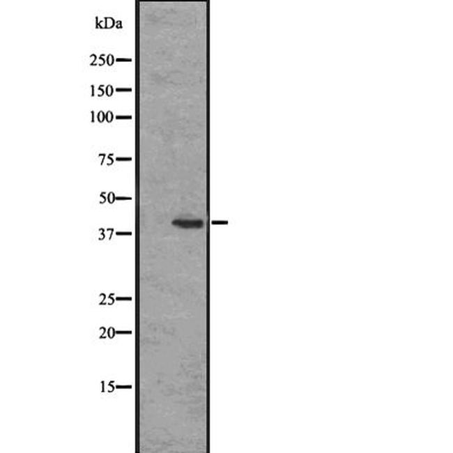 EDG8 Antibody in Western Blot (WB)