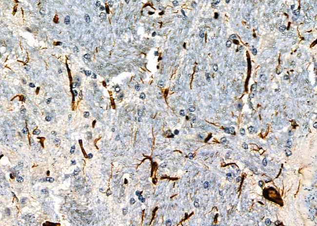 OR52Z1P Antibody in Immunohistochemistry (Paraffin) (IHC (P))