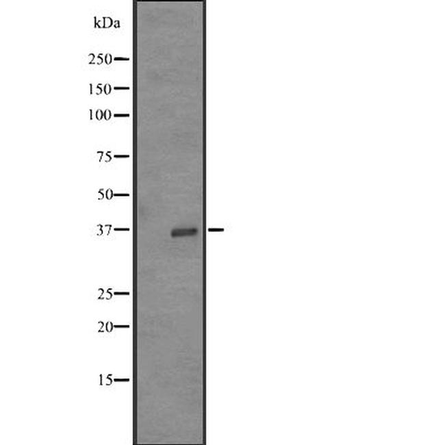 OR52Z1P Antibody in Western Blot (WB)