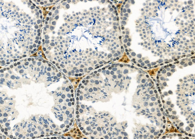 GPR21 Antibody in Immunohistochemistry (Paraffin) (IHC (P))