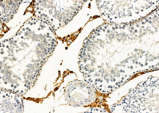 GPR21 Antibody in Immunohistochemistry (Paraffin) (IHC (P))