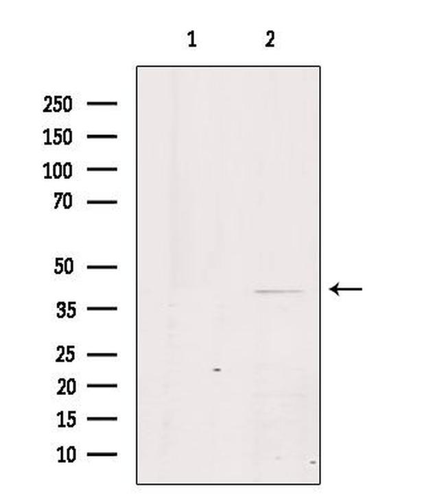 GPR21 Antibody in Western Blot (WB)