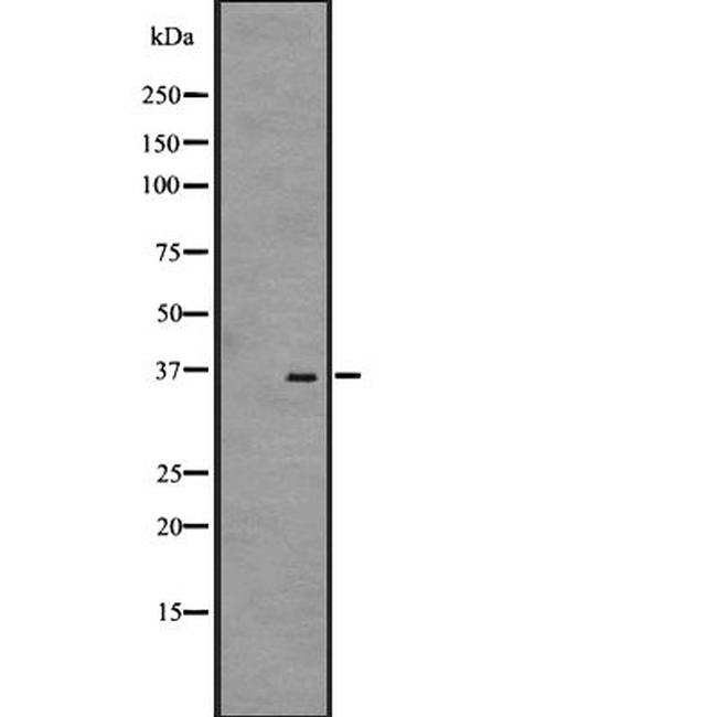 GPR35 Antibody in Western Blot (WB)