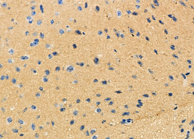 NPBWR2 Antibody in Immunohistochemistry (Paraffin) (IHC (P))