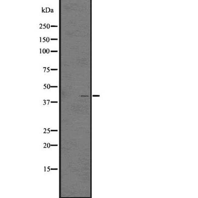 LPAR5 Antibody in Western Blot (WB)