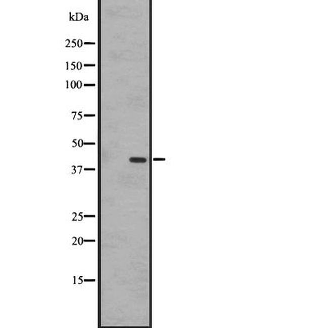 GPR183 Antibody in Western Blot (WB)