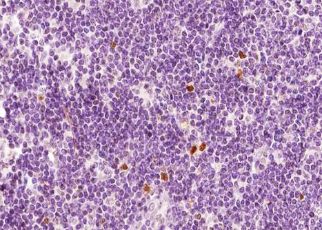 CXCR2 Antibody in Immunohistochemistry (Paraffin) (IHC (P))