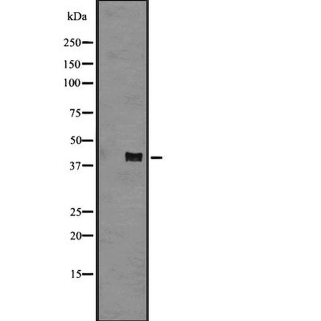 CXCR2 Antibody in Western Blot (WB)