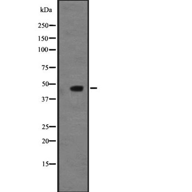 NMUR2 Antibody in Western Blot (WB)